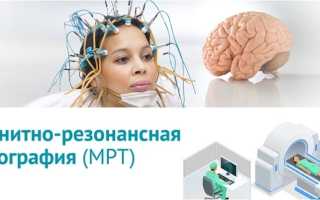 Отличия ЭЭГ и МРТ при обследовании головного мозга