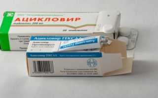 Как правильно лечить герпес на ягодицах?