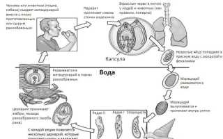 Легочный сосальщик: какие заболевания вызывает, симптомы и методы лечения