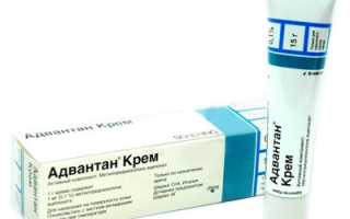 Обзор эффективных кремов от псориаза