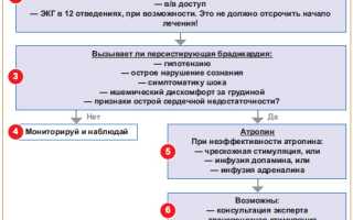 Происхождение и лечение тахикардии и брадикардии