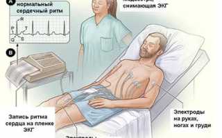 Как правильно проводить электрокардиографическое исследование?