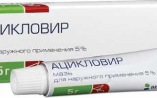Лечение и симптомы генитального герпеса у мужчин и женщин