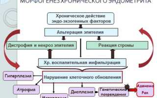Лечение хронического эндометрита — как проявляется патология
