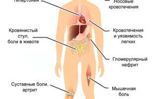 Васкулит: что это за заболевание? Симптомы, причины, профилактика и лечение