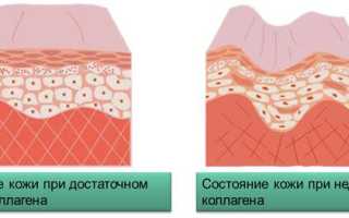 Маски для лица от морщин. Рецепты против старения кожи